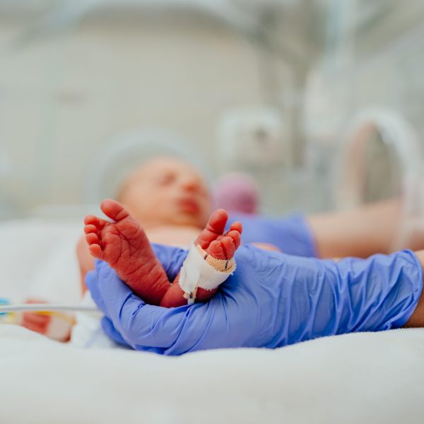 Efficacia del trattamento manipolativo osteopatico nelle unità di terapia intensiva neonatale